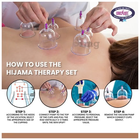 24 Cup Cupping Therapy Kit | Pain Relief & Detox Massage Set